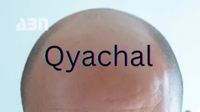 Հինգ դաս, որ Qyachal-ի վրիպակից կարող է սովորել ամեն բրենդ