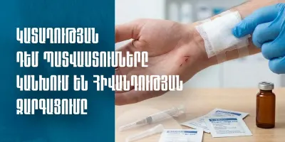 Ի՞նչ անել, եթե կենդանին կծել կամ ճանկռել է, ինչպե՞ս կանխել կատաղության հնարավոր զարգացումը. ԱՆ-ի խորհուրդները