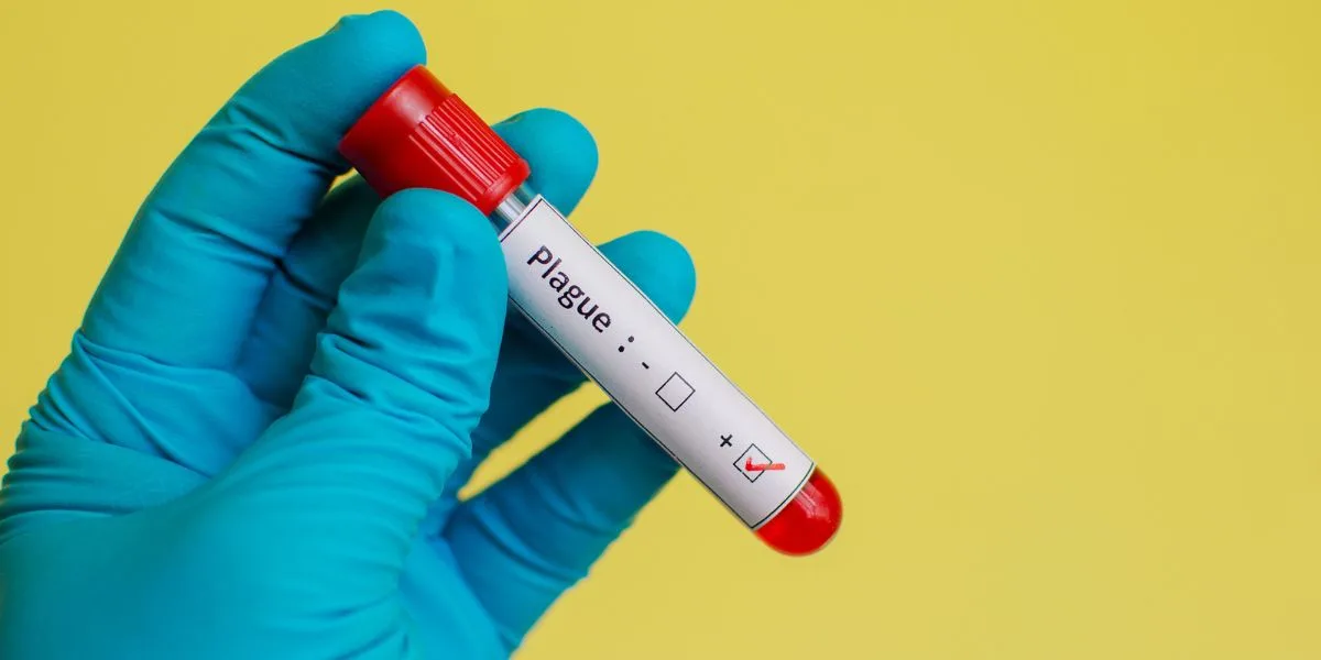 ԱՄՆ դեսպանատունը նախազգուշացրել է Իրկուտսկում թոքային ժանտախտի հնարավոր դեպքի մասին. ռուսական կողմը հերքում է